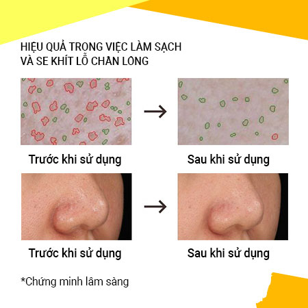 Mặt nạ se khít lỗ chân lông innisfree Super Volcanic Pore Clay Mask 2X 20 mL
