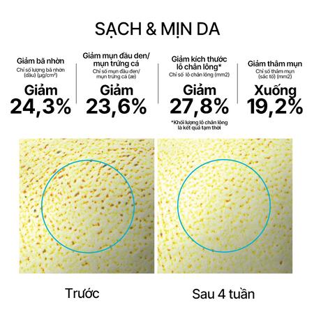 Set tinh chất phục hồi Retinol & tinh chất dưỡng ẩm trà xanh Green Tea Seed Hyaluronic Serum combo