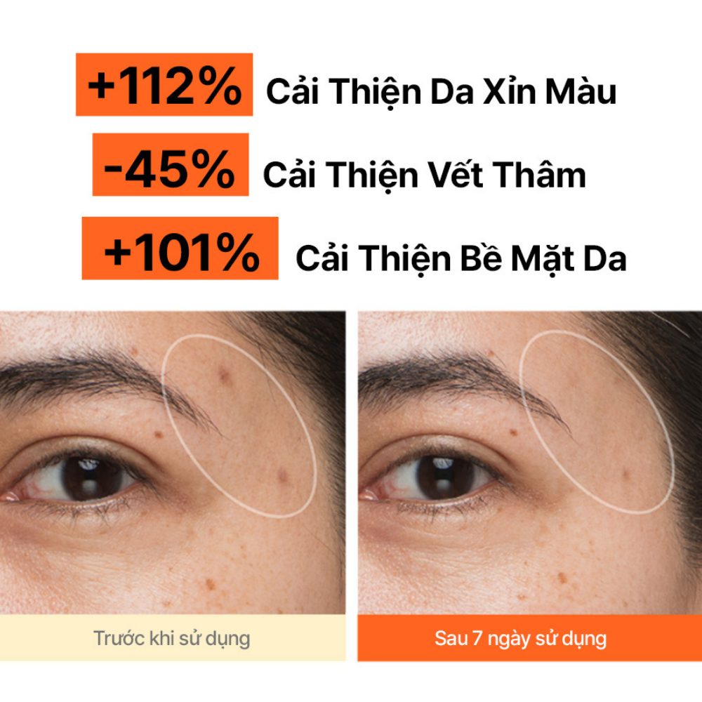 Serum Vitamin C sáng da, mờ thâm mụn INNISFREE Green Tea Enzyme Brightening Serum 50ml